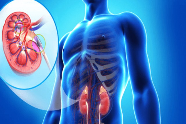 HOW TO KEEP YOUR KIDNEYS SAFE AND STRONG