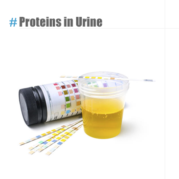 Proteins in urine