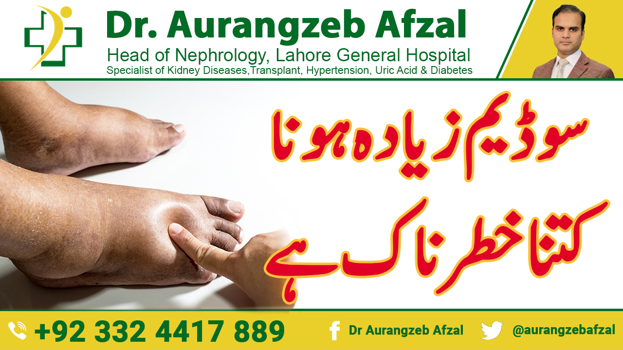 Sodium Ziada hona, Kitna khatarnak hai - High Sodium(Hypernatremia) in Urdu/Hindi