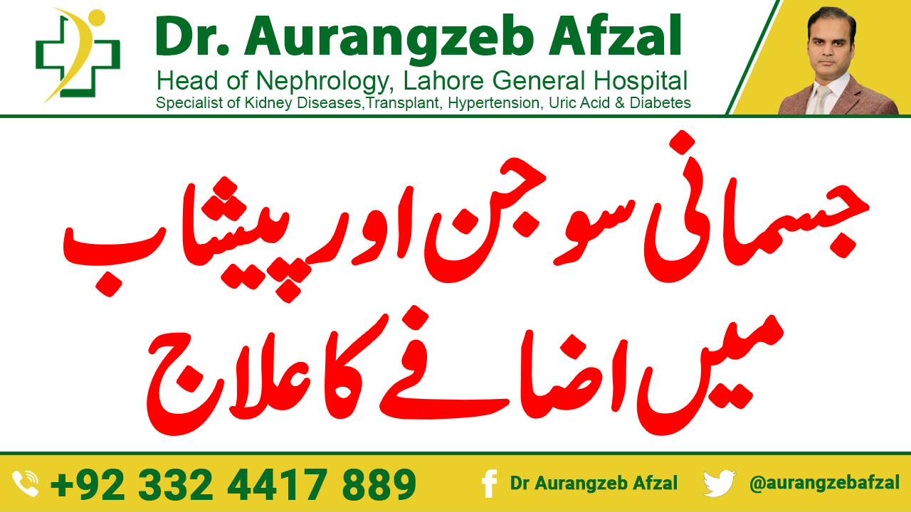 Treatment of Body Swelling and increasing urine in Urdu Hindi Treatment of Body Swelling and increasing urine in Urdu Hindi