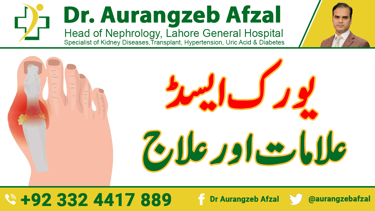 Sign, Symptoms and Treatment of Uric Acid in Urdu by Dr Aurangzeb Afzal Sign, Symptoms and Treatment of Uric Acid in Urdu by Dr Aurangzeb Afzal
