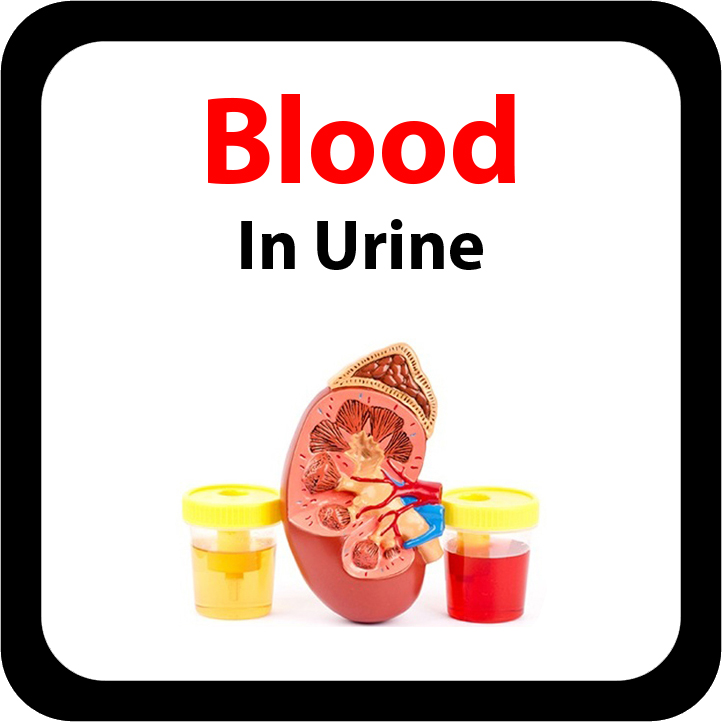Blood In Urine