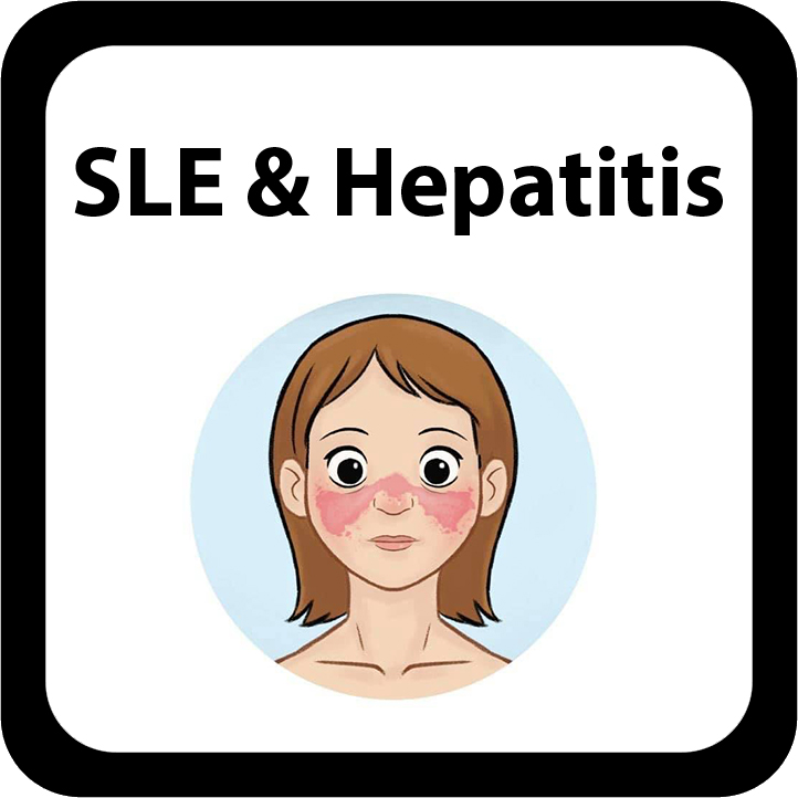 SLE & Hepatitis